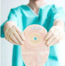 Ostomy bag